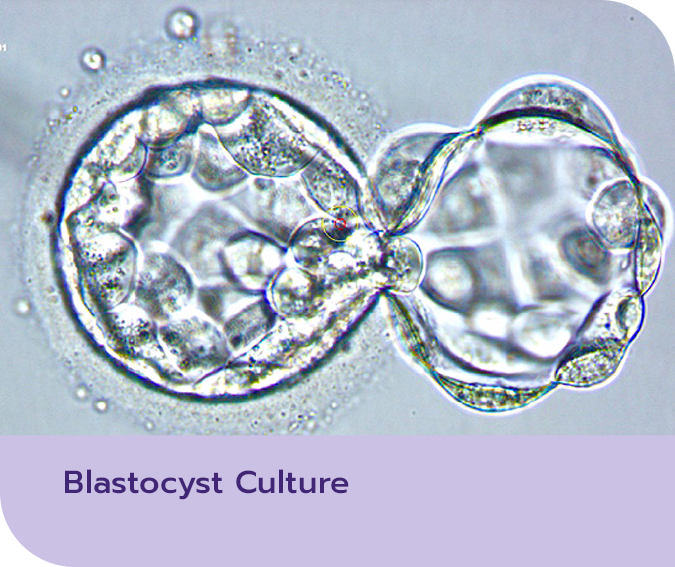 บลาสโตซิสต์ คัลเจอร์ (Blastocyst culture)